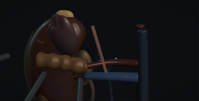 Operative plate: Adrenalectomy