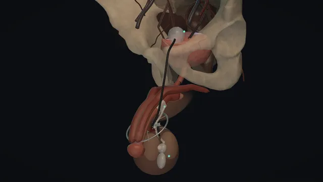 Operative plate: AUS: penoscrotal approach