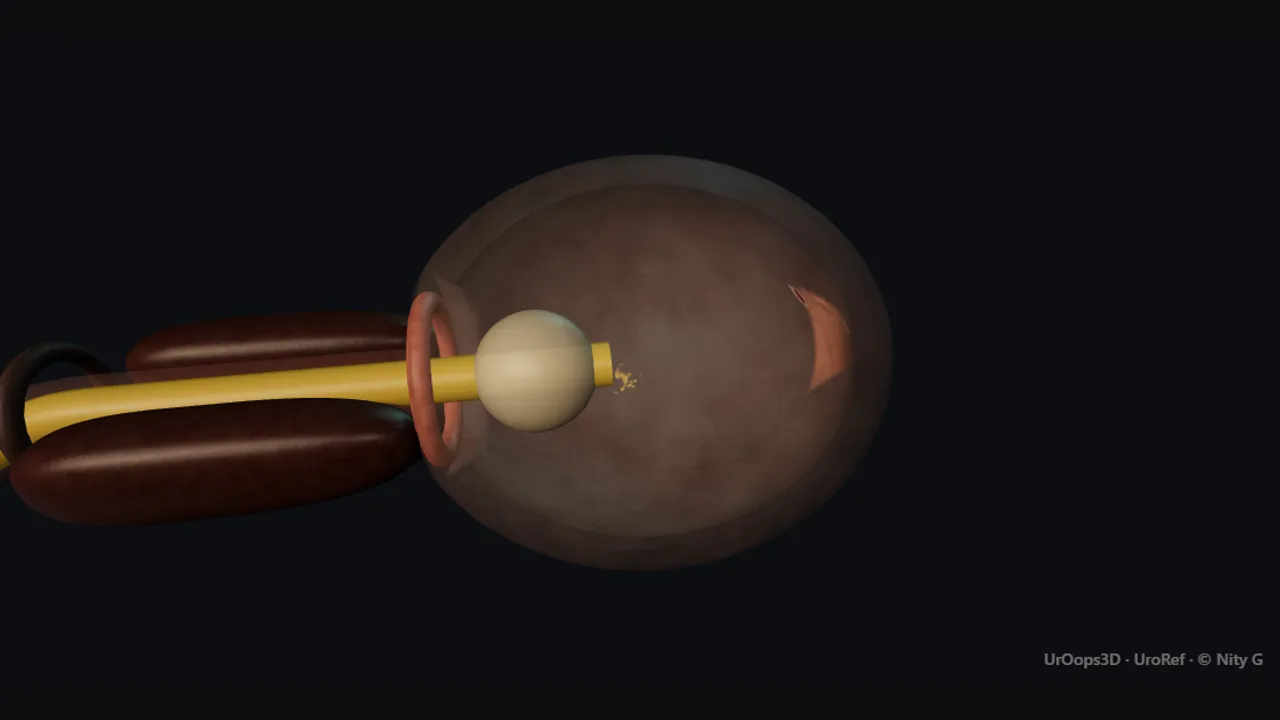 Rendered frame from the Interactive model: the catheter, curve by curve