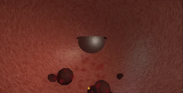 Operative plate: Clot retention: evacuation and haemostasis