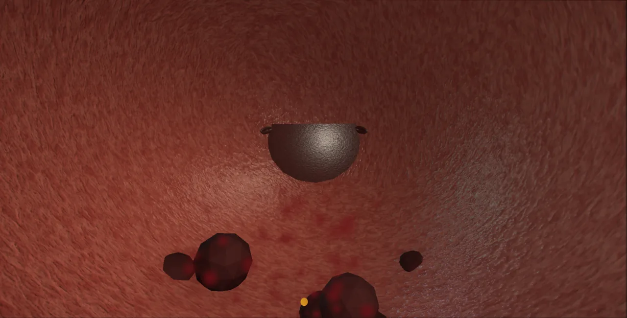 Clot evacuation: the resectoscope sheath in a bladder full of clot