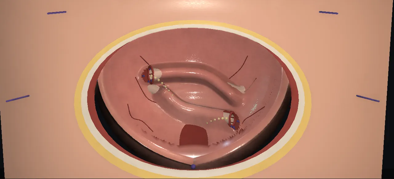 Rendered frame from the Interactive Cohen reimplantation