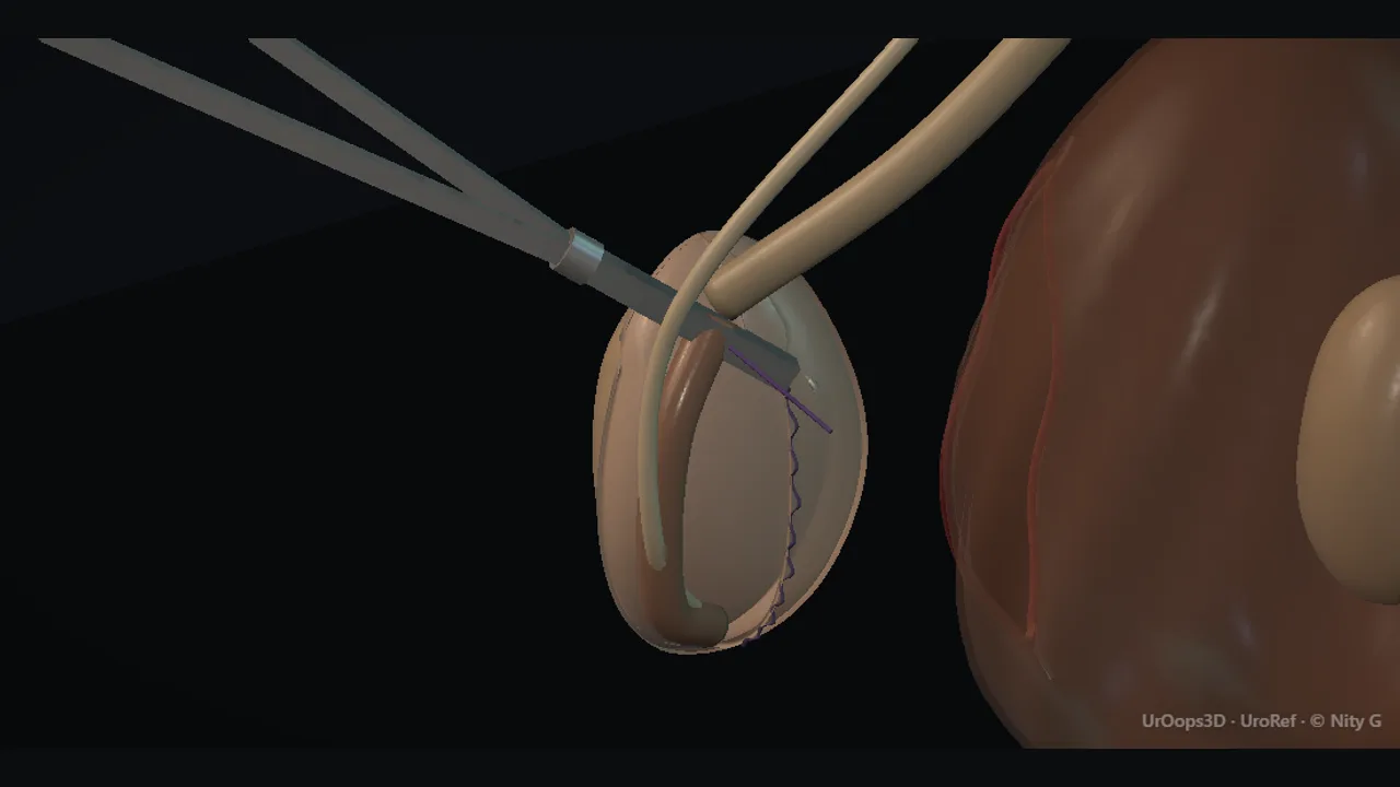 Rendered frame from the Interactive operative model