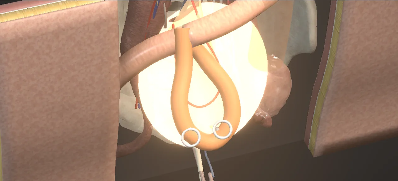 Rendered frame from the Interactive ileal ureter