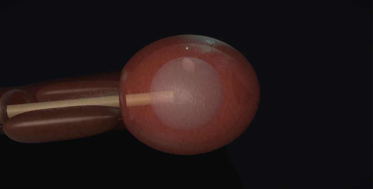 Rendered frame from the Interactive immediate mitomycin model