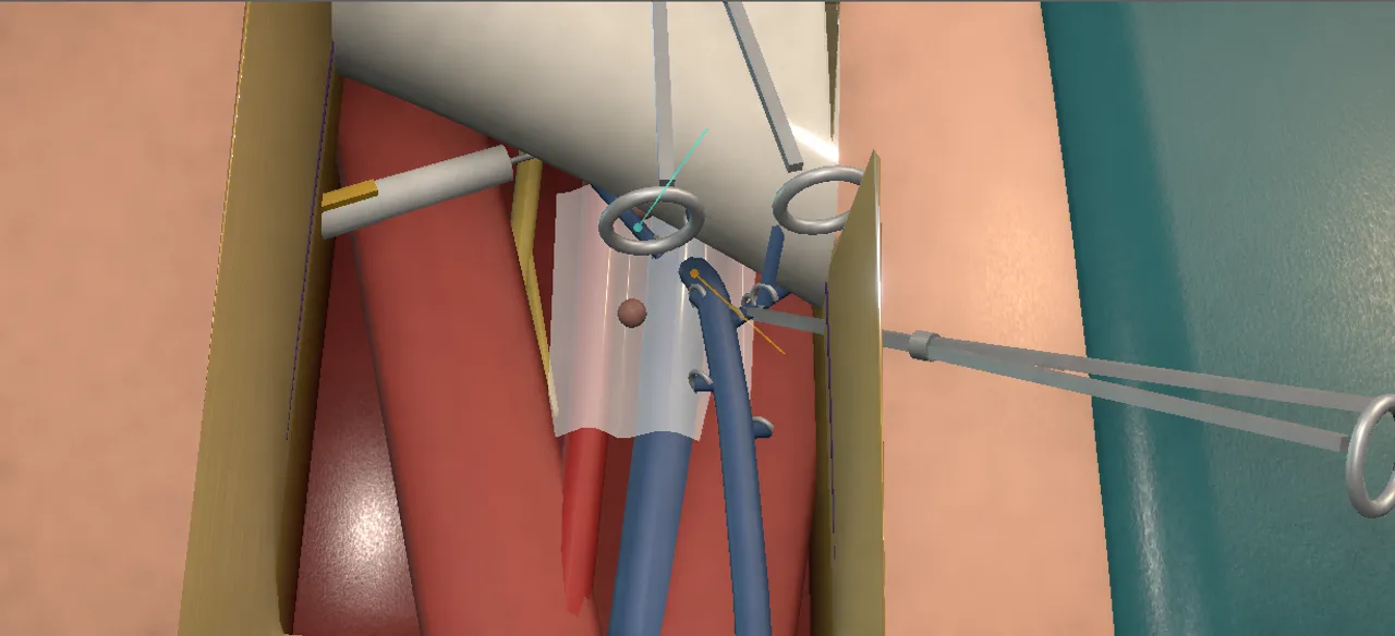 Rendered frame from the Interactive inguinal lymph node dissection