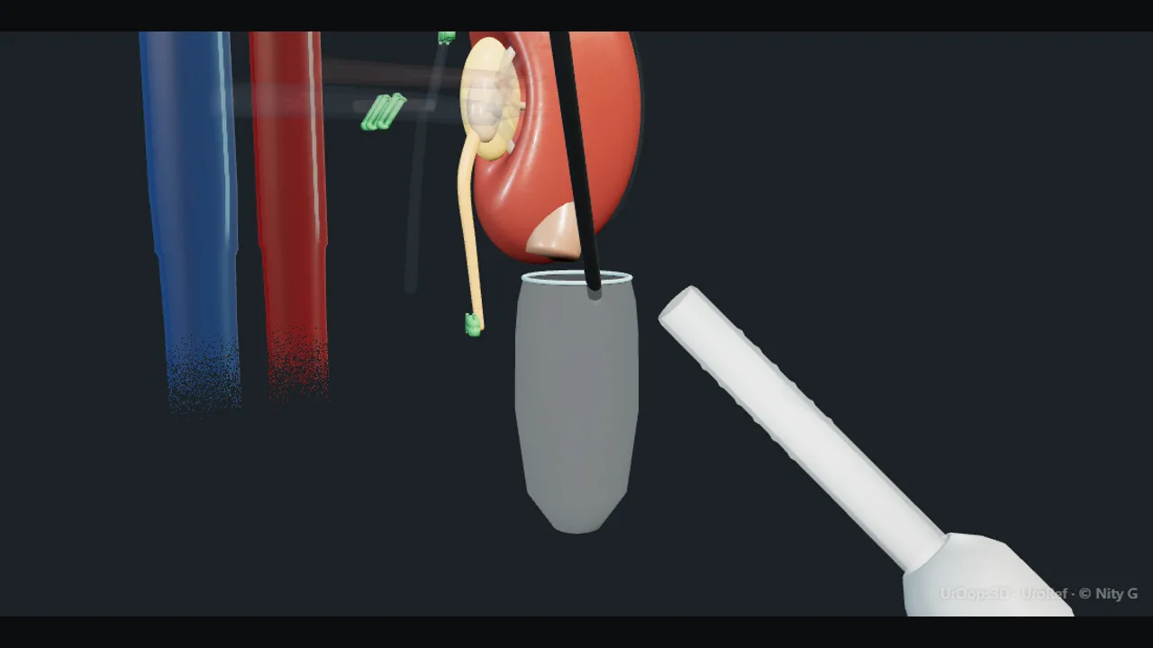 Rendered frame from the Interactive laparoscopic donor nephrectomy