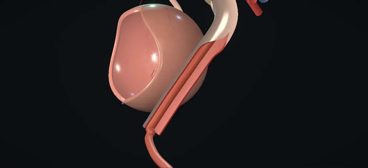 Rendered frame from the Interactive megaureter repair