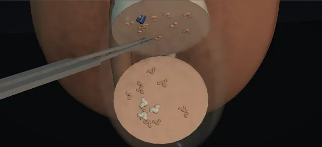 Operative plate: MicroTESE