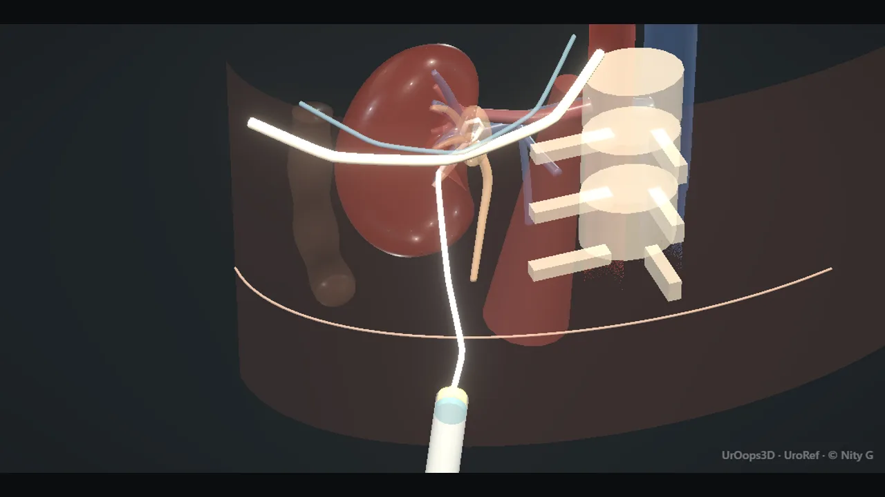 Rendered frame from the Interactive operative model