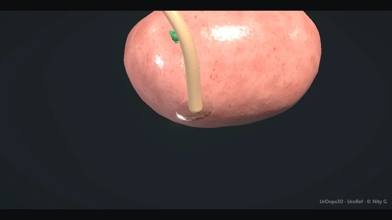 Rendered frame from the Interactive operative model
