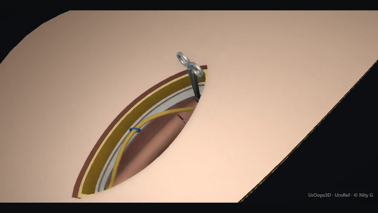 Rendered frame from the Interactive operative model