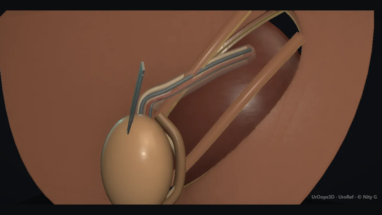 Rendered frame from the Interactive operative model