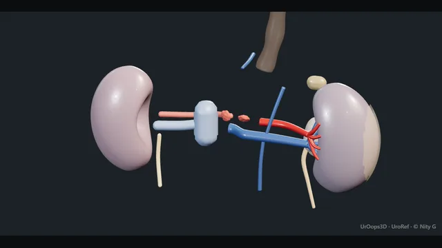 Operative plate: Deceased-donor kidney retrieval