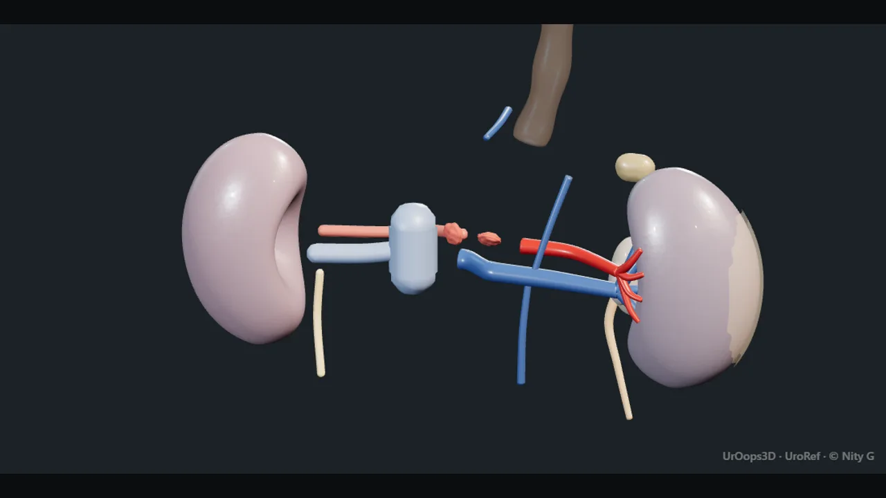 Rendered frame from the Interactive deceased-donor kidney retrieval