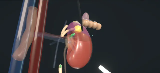Operative plate: Paediatric nephrectomy and heminephrectomy