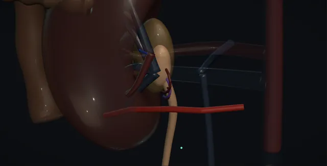 Operative plate: Paediatric pyeloplasty
