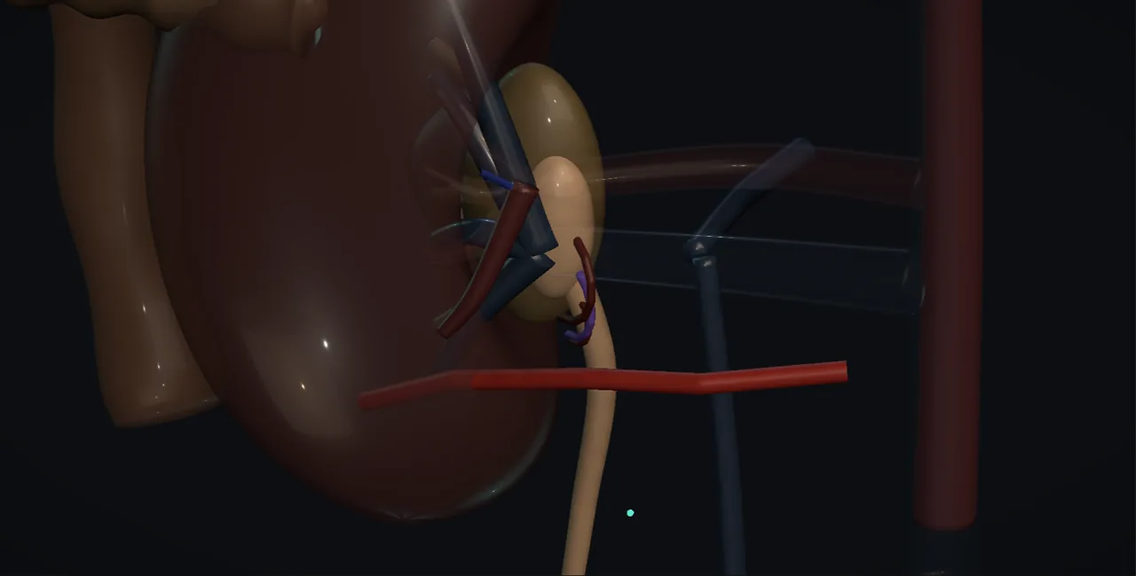 Rendered frame from the Interactive dismembered pyeloplasty