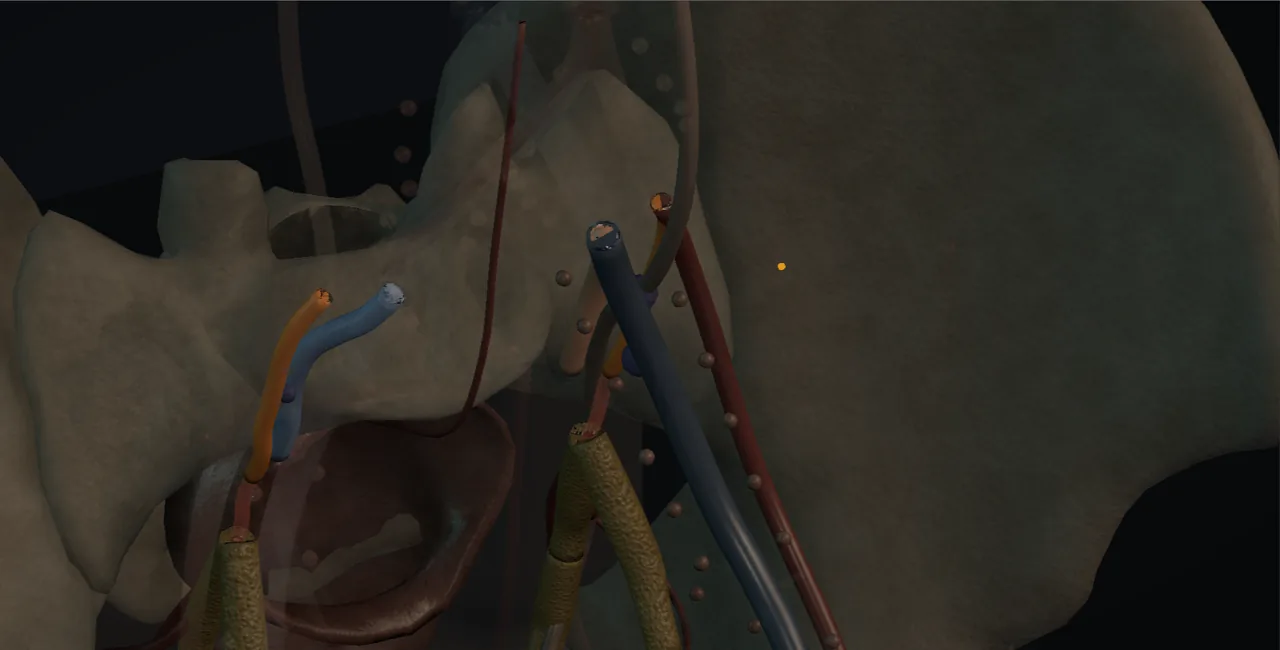 Rendered frame from the Interactive pelvic exenteration