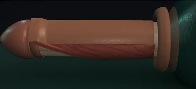 Operative plate: Penile skin flap urethroplasty