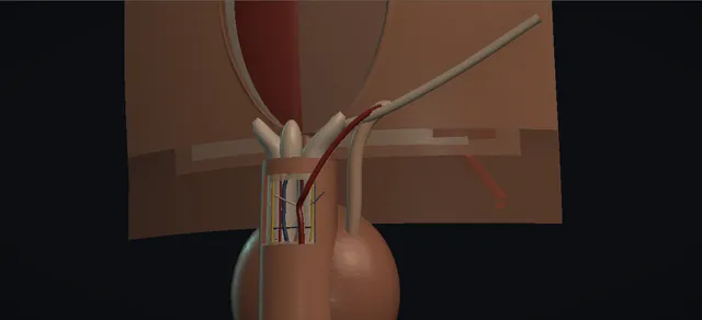 Operative plate: Penile arterial revascularisation