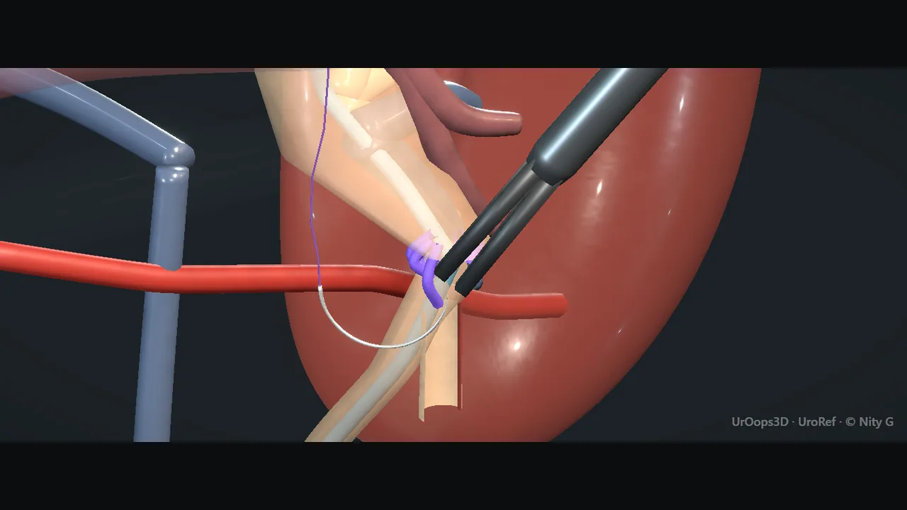 Rendered frame from the Interactive operative model