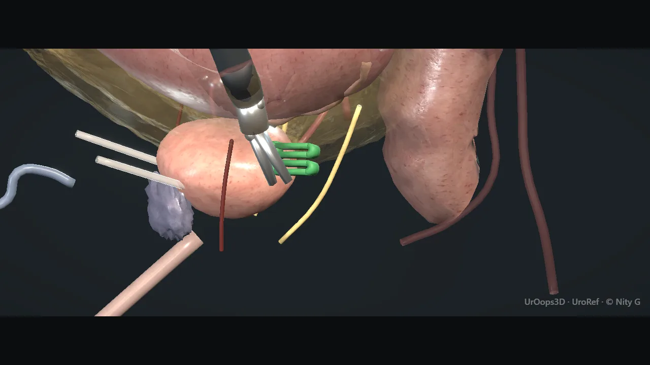 Rendered frame from the Interactive operative model