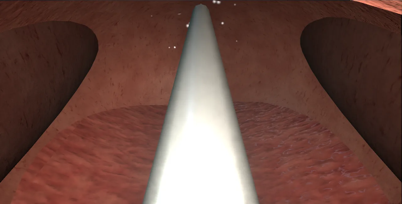 Rendered frame from the Interactive water-vapour therapy