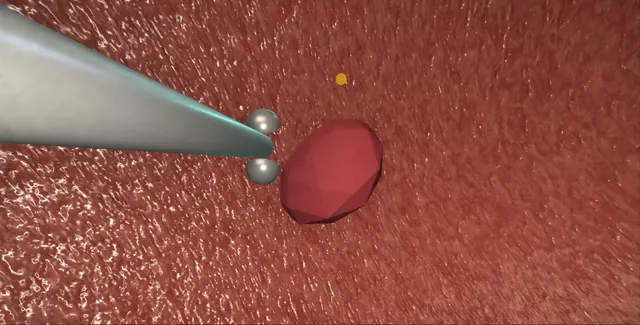 Operative plate: Rigid cystoscopy, biopsy and fulguration