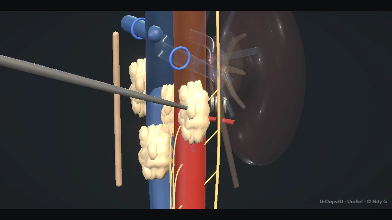 Rendered frame from the Interactive operative model