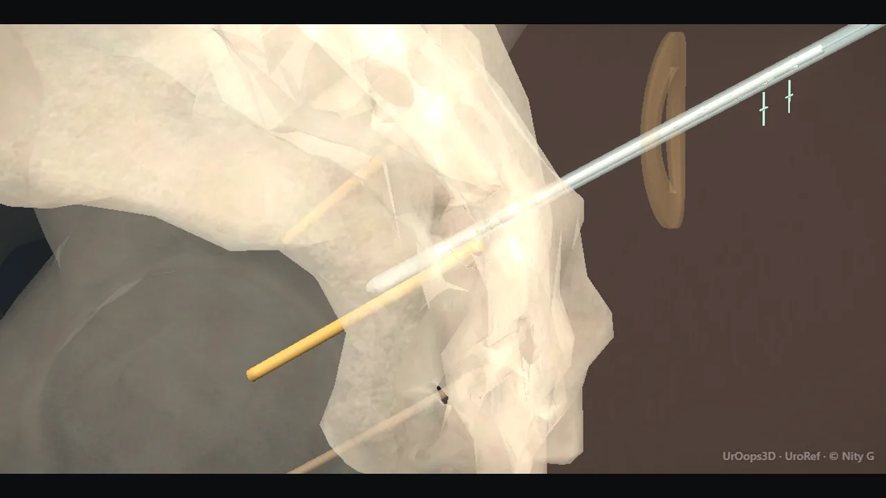 Rendered frame from the Interactive operative model