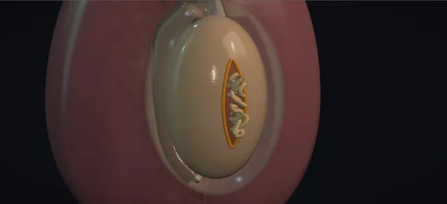 Operative plate: Scrotal trauma: exploration