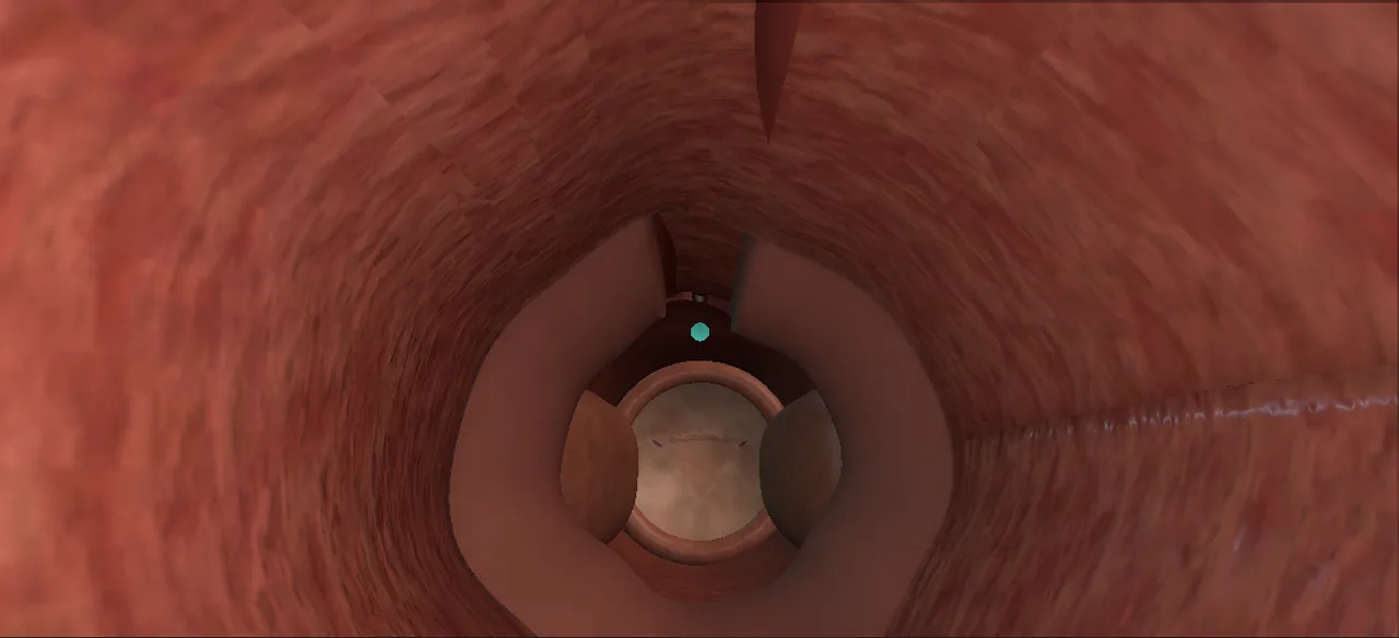 Rendered frame from the Interactive external sphincterotomy