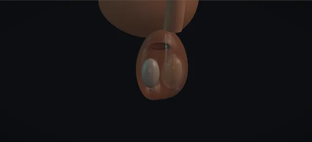 Operative plate: Testicular prosthesis