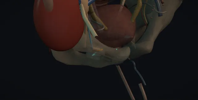 Operative plate: Transplant ureteric reconstruction