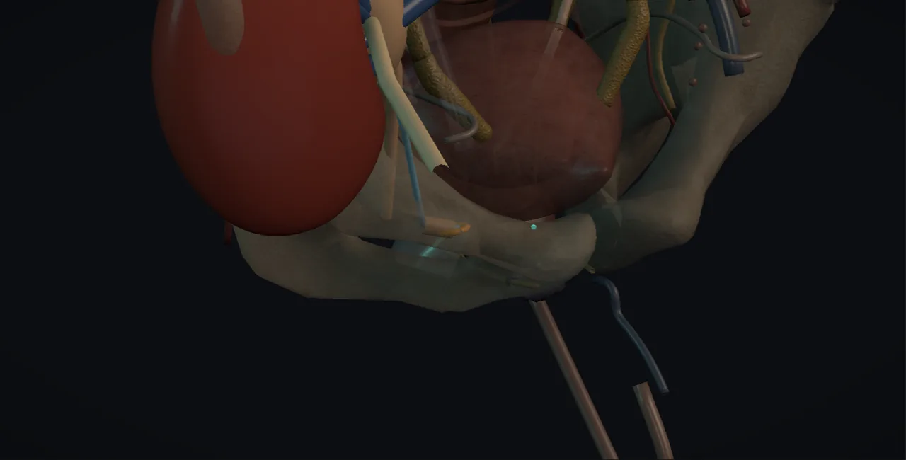Rendered frame from the Interactive transplant ureteric reconstruction