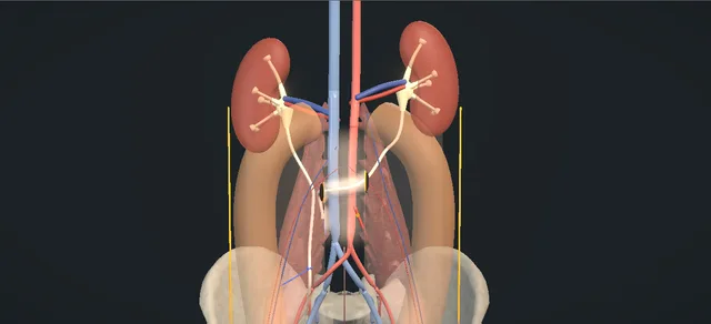Operative plate: Transureteroureterostomy