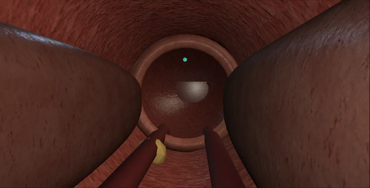 Rendered frame from the Interactive bladder neck incision