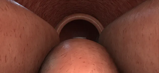 Operative plate: TURP: the resection, beat by beat