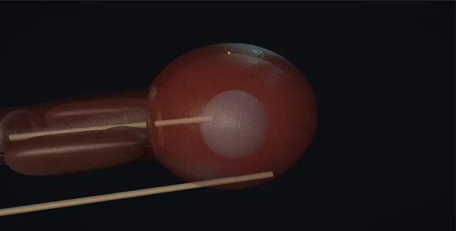 Operative plate: Urodynamics