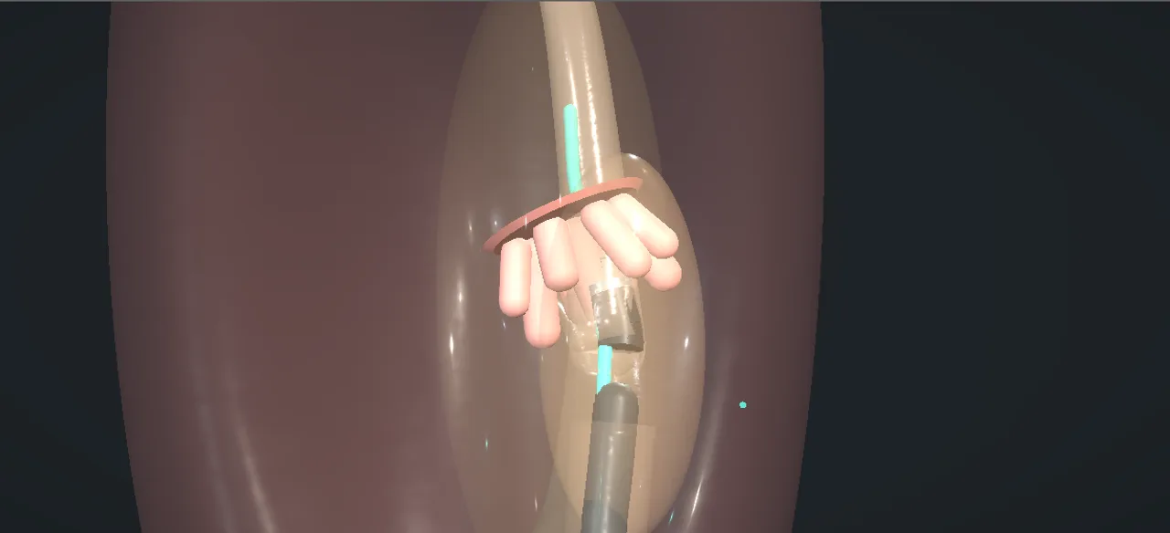 Rendered frame from the Interactive ureteroscopic biopsy and laser ablation