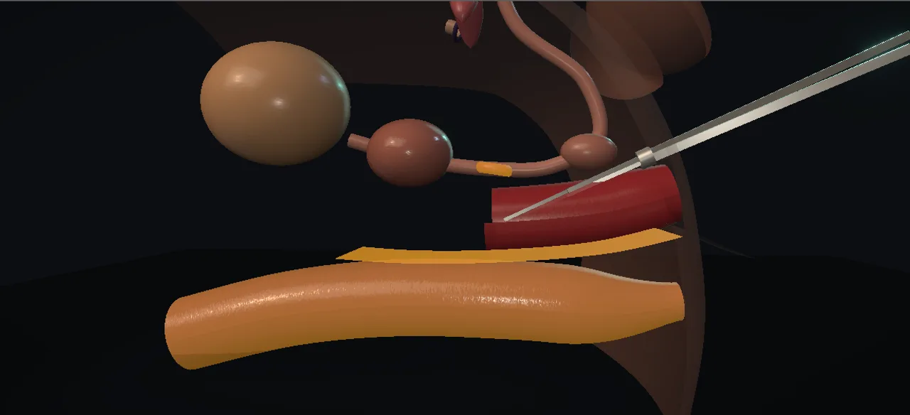 Rendered frame from the Interactive penile inversion vaginoplasty