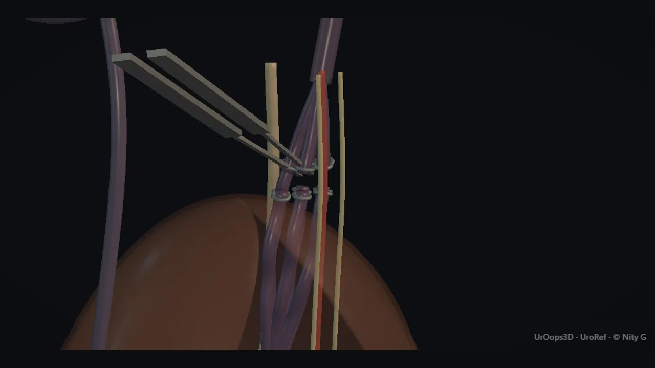 Rendered frame from the Interactive operative model