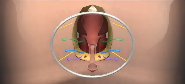 Operative plate: York-Mason fistula repair