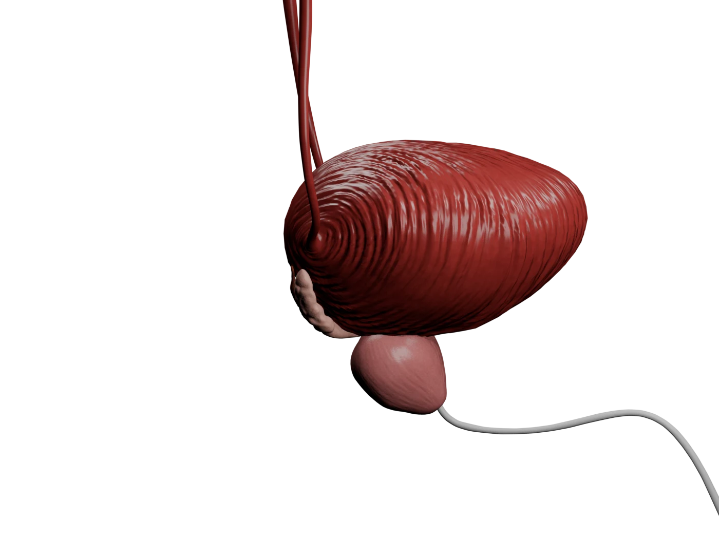 Annotated lateral bladder view; an amber line marks the obturator nerve danger corridor immediately beyond the lateral wall