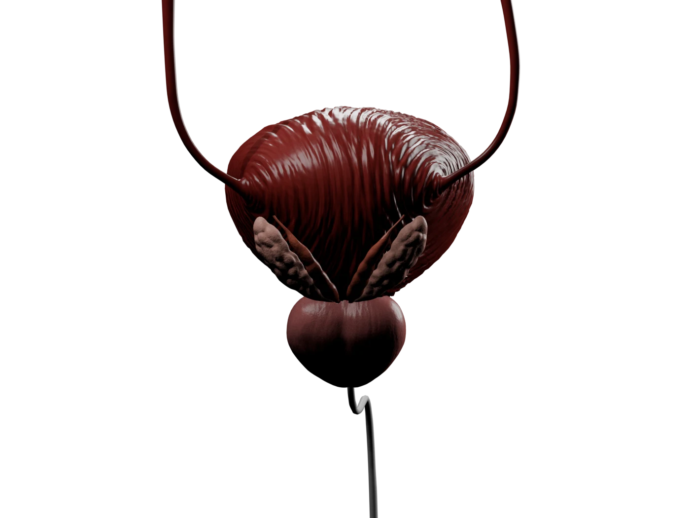 Annotated inferior pelvic view; an amber line marks the obturator nerve danger corridor beside the bladder base