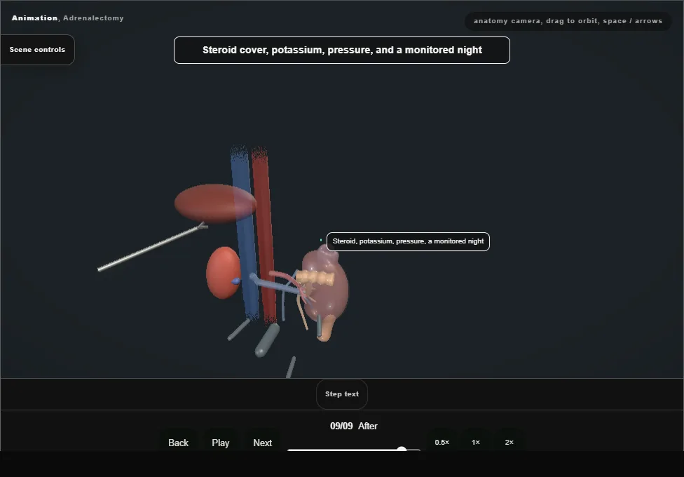 Adrenalectomy. Step 9: After. Captured frame from the interactive animation.