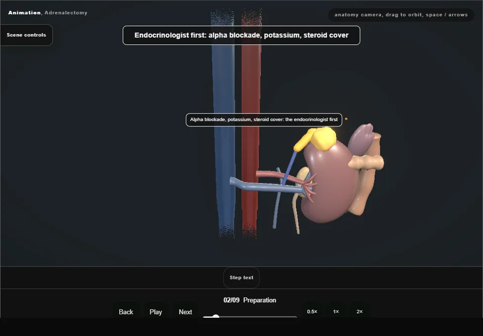 Adrenalectomy. Step 2: Preparation. Captured frame from the interactive animation.