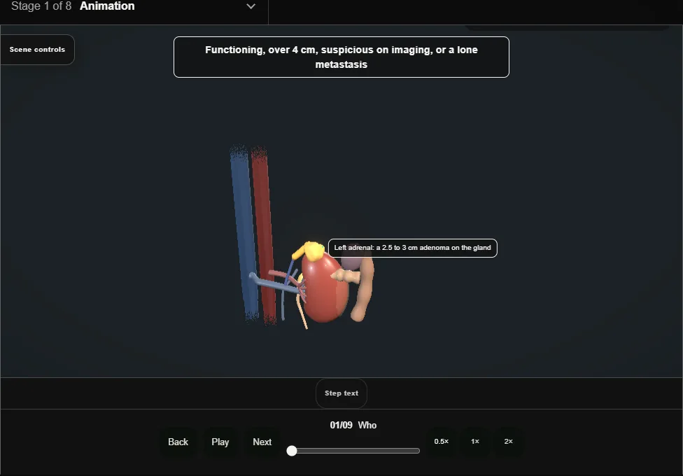 Adrenalectomy. Step 1: Who. Captured frame from the interactive animation.