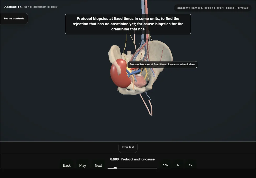 Renal allograft biopsy. Step 2: Protocol and for-cause. Captured frame from the interactive animation.